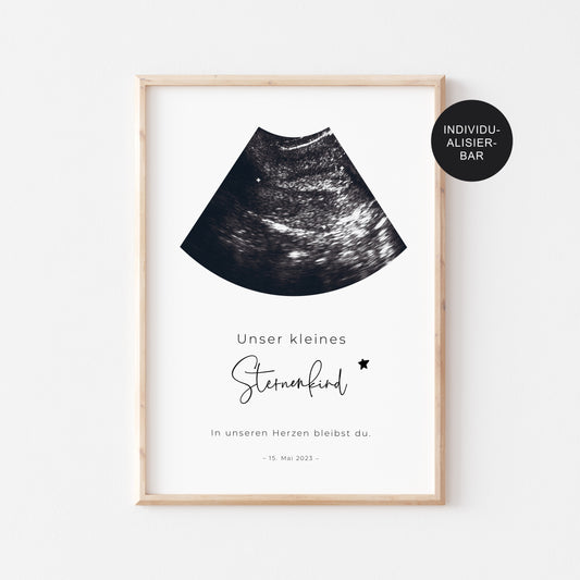 Sternenkind Erinnerung Poster – Andenken Fehlgeburt – Verlust Baby