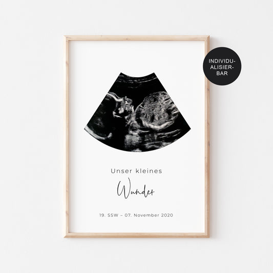 Poster Ultraschallbild – Babyposter mit Geburtsdaten für Kinderzimmer